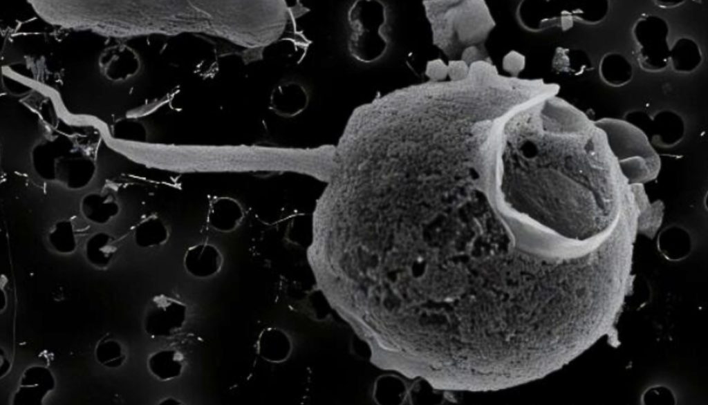 Plankton rünnaku all: ookeaniviirus on saanud rekordilise relva